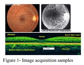 سیستم هوشمند تشخیص بیماری چشم در چشم پزشک الکترونیکی