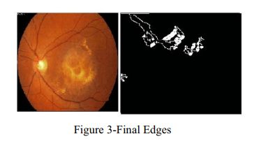 سیستم هوشمند تشخیص بیماری چشم در چشم پزشک الکترونیکی